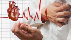 Các yếu tố nguy cơ tim mạch thường gặp nhất.